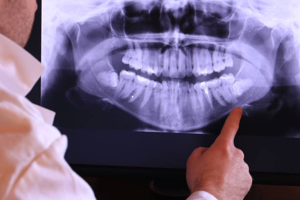 Best Emergency Dental Care for Abscessed Tooth in Connersville, IN