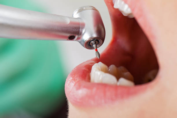 Best Emergency Dental Services for Seniors in Connersville, IN